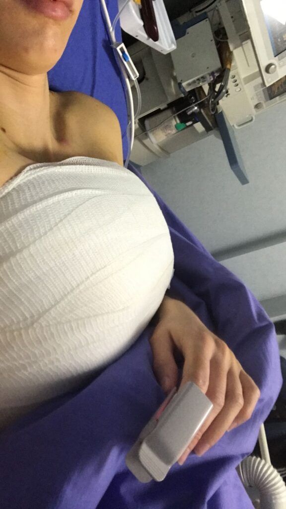 io post operazione con la dottoressa Marzia Moio