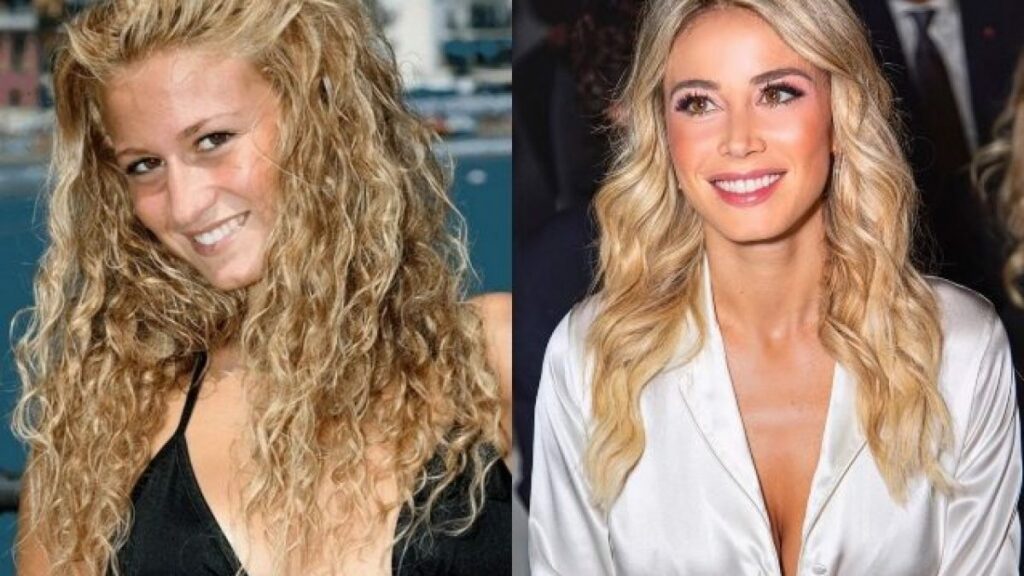 Diletta Leotta prima/dopo