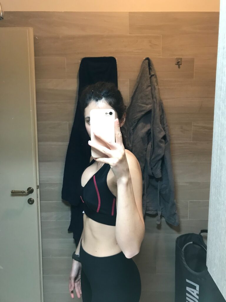 visione laterale post operazione con la dottoressa Marzia Moio