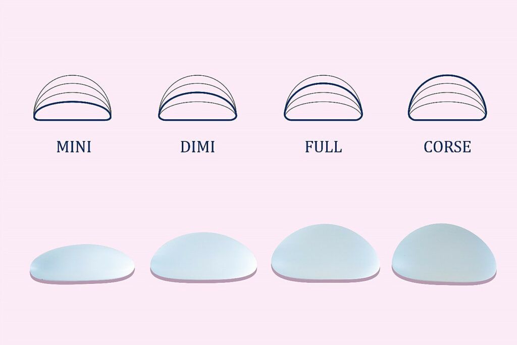 quale proiezione scegliere delle protesi