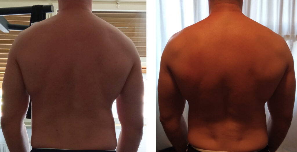 spalla storta a dritta