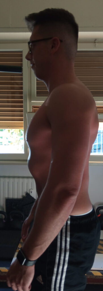 estremizzazione a fini estetici