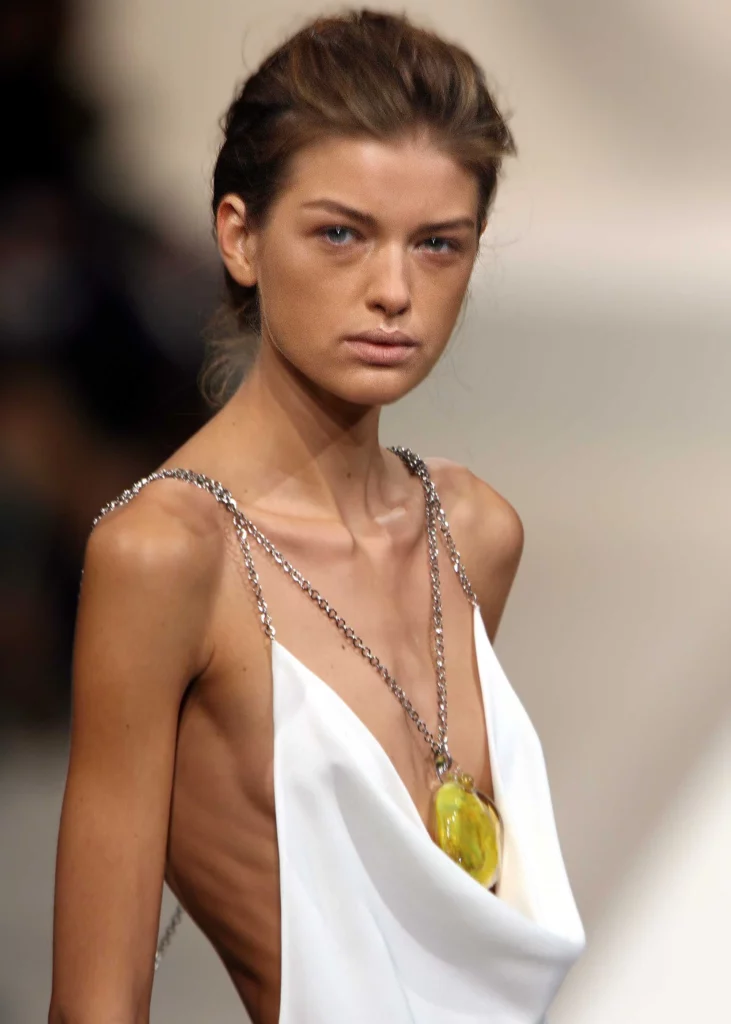 foto modella troppo magra