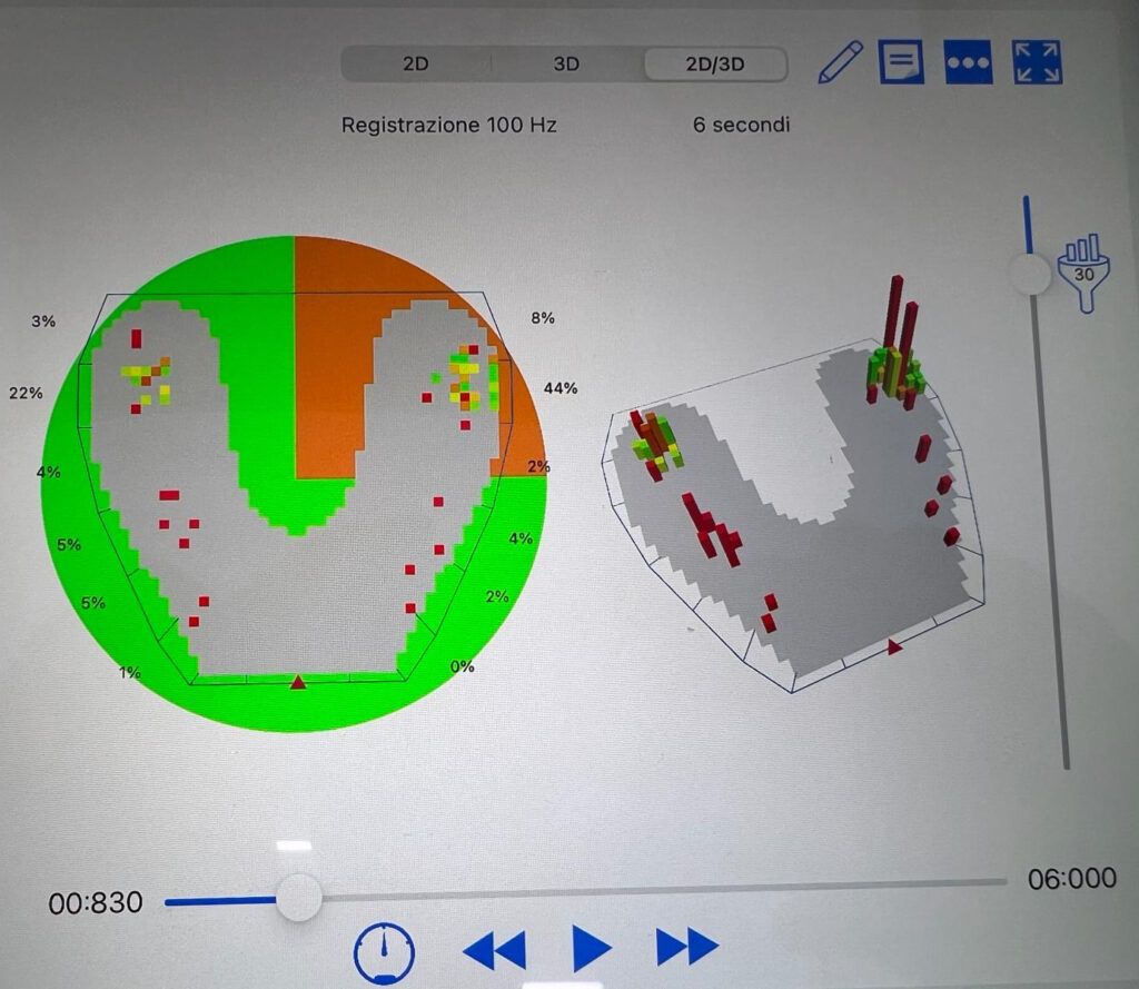 Un dente mi ha rovinato la schiena